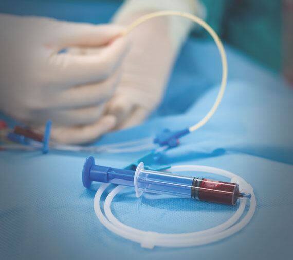 Central venous access and dialysis