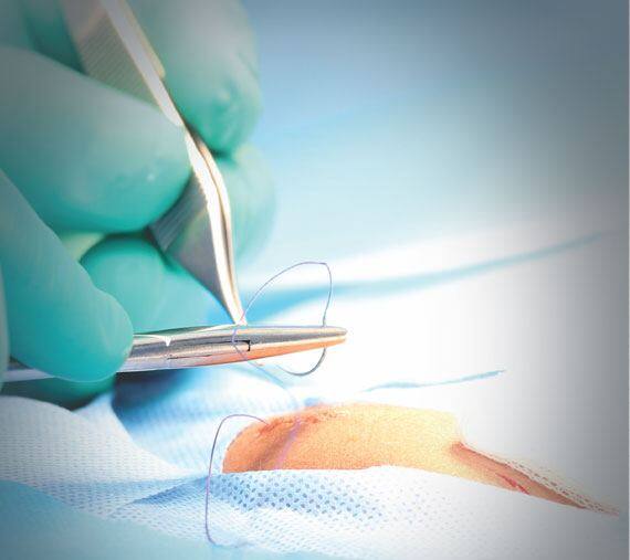 Surgery products